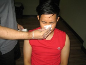 Managing a Nose Bleed