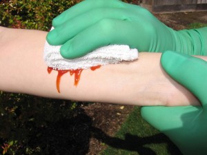first aid treatment for bleeding patient